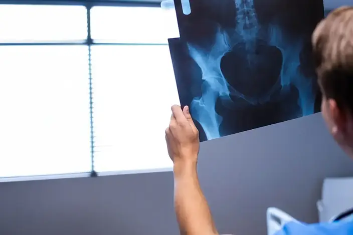 man holding up an x-ray