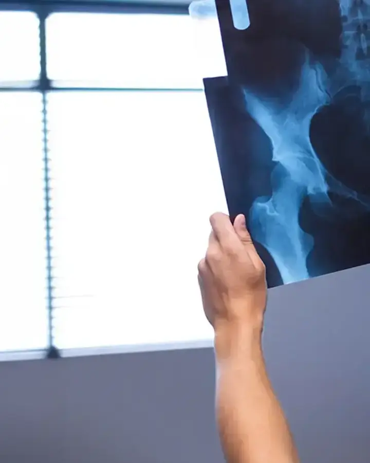 man holding up an x-ray