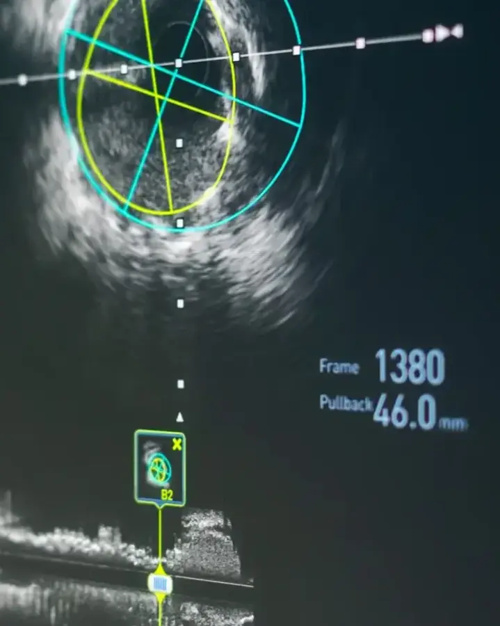 screen with scan results